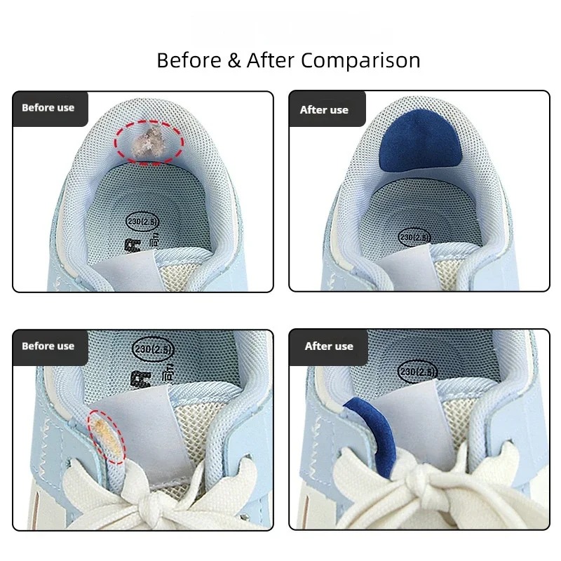 สติ๊กเกอร์ซ่อมรองเท้าป้องกันกา - Sneaker Care Service บทวิจารณ์และราคา